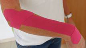 Kinesiology Taping